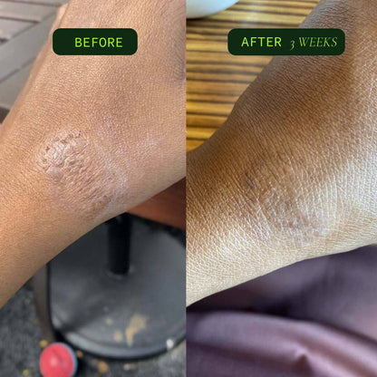 Coriander Seed Omega Body Oil